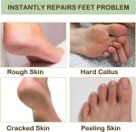 Cracked Heels Moisturizer Silicon Socks for Women, Moisturizing Gel Socks, Spa Pedicure Socks, Silicone Socks for Cracked Feet, Foot Care, Soft Heel Protector, Reusable Waterproof Socks For Man And Woman - Image 5