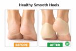 Cracked Feet Care Socks, Moisture Locking, Cracked Heel Repair, Dry Skin Protection 1 pair - Image 3