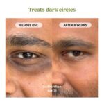 Vilvah Under Eye Cream | Reduces Dark Circles, Puffiness & Eye Bags | Hydrates, Smoothens Fine Lines & Firms Skin | Lightweight Cream for Tired Eyes | 20ml - Image 4