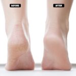 Silicone Gel Heel Pad Socks Heel Pain Relief Anti Crack Silicone Gel Heel And Foot Protector Moisturizing Socks for Foot Care, leg pain relief (GEL HEEL SOCKS) - Image 8