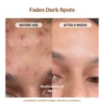 Vilvah Milk Drops Brightening Serum | Fades Dark Spots, Treats Hyperpigmentation & Evens Skin Tone | Hyaluronic Acid & Alpha Arbutin Serum for Women & Men | Suitable for All Skin Types | 20ml - Image 4