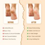 Silicone Moisturizing Heel Socks With Strap For Cracked Heels, Dry Feet Repair Gel Spa Socks With Anti Slip Grip, Soft, Breathable, Reusable, Washable Pain Relief Foot Care Socks For Men & Women(White) - Image 5