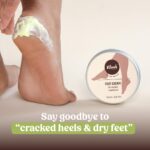 Vilvah Foot Cream for Cracked Heels | Repairs Dry, Rough & Damaged Feet | Softens Calluses & Removes Dead Skin | Deep Hydration & Odour Control | 100ml - Image 2