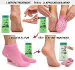 Varenza Moisturising Silicone Gel Socks with Foot Massager Cream for Cracked Heels & Pain Relief Spa Repair Foot Care Socks with Vitamin E & Essential Oils (1 Pair socks & 1 Cream) - Image 2