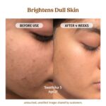 Vilvah Milk Drops Brightening Serum | Fades Dark Spots, Treats Hyperpigmentation & Evens Skin Tone | Hyaluronic Acid & Alpha Arbutin Serum for Women & Men | Suitable for All Skin Types | 20ml - Image 5