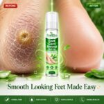 FeetGo Foot Corn Care Roll-On with Aloe Vera and Tea Tree, Moisturising Formula for Dry Rough Feet, 15ml - Image 7