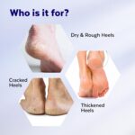20% Urea Crack Heel Repair Foot Cream Roll On 50ml Foot Cream For Dry And Cracked Feet With 2% Lactic Acid, Olive Oil & Vitamin E | Help Heel Repair and Moisturise Cracked Heels - Image 6